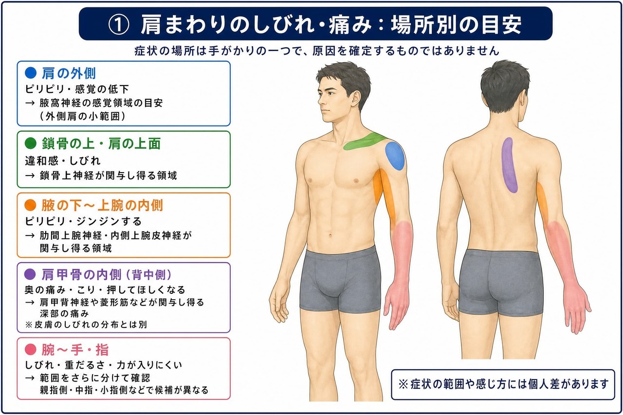 肩の痛みとしびれが出る場所別の分布図。肩の外側は腋窩神経、脇の下から二の腕の内側は肋間上腕神経と内側上腕皮神経、肩甲骨の内側は肩甲背神経、腕から手や指は首から続く神経が関わり得る領域