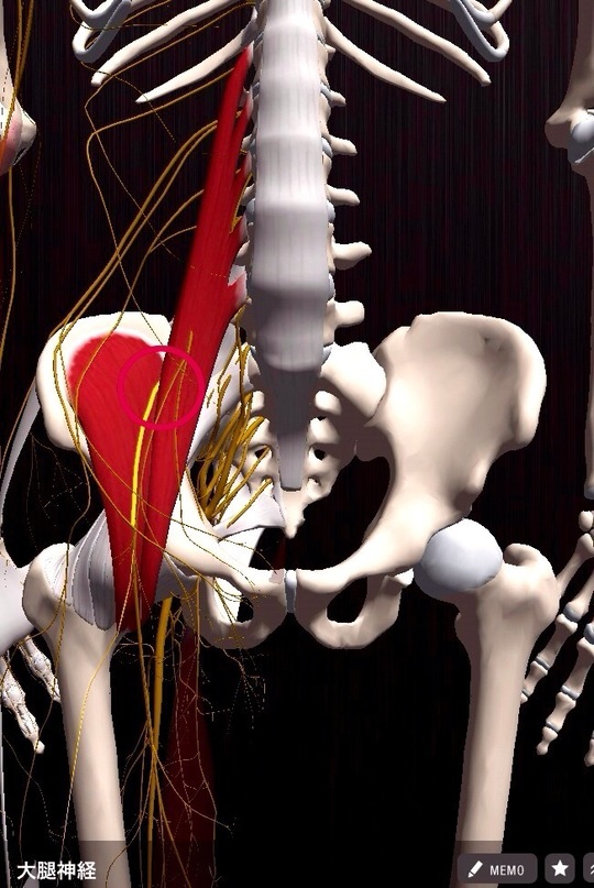 大腿神経痛 外側大腿皮神経痛の原因と治療 三軒茶屋駅 手足のしびれ 神経痛ならアールカイロプラクティックセンター